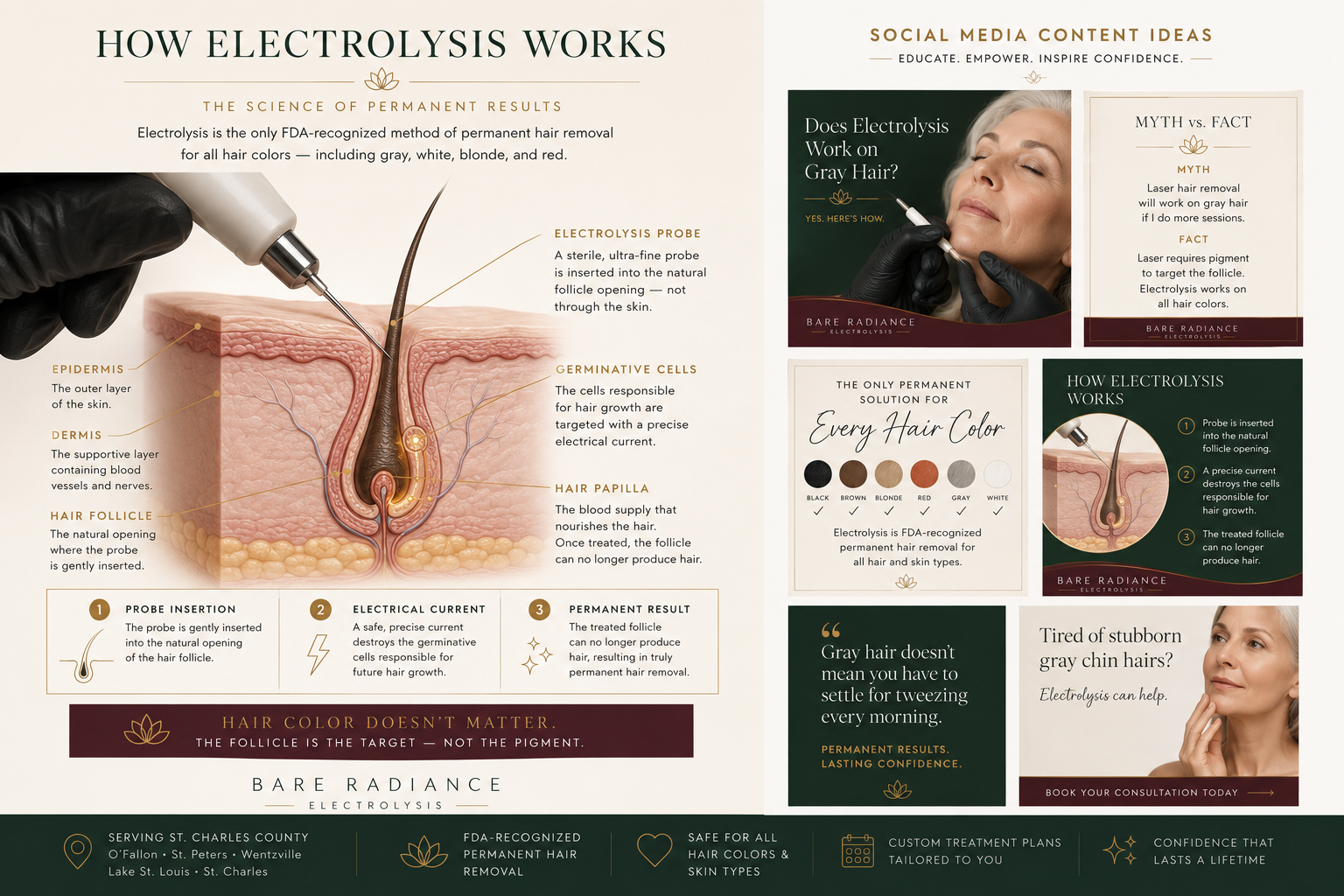 Educational infographic showing how electrolysis works — probe insertion, electrical current destroying germinative cells, and permanent result — with comparison of laser vs electrolysis for gray hair and all hair colors